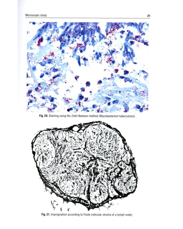 Macro- and microscopic diagnosis in practical classes in pathological anatomy. Atlas : tutorial guide. (кн. на англ. яз.)