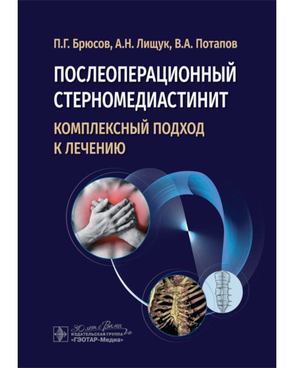 Послеоперационный стерномедиастинит. Комплексный подход к лечению