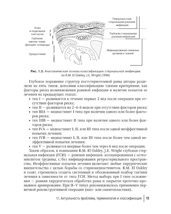 Послеоперационный стерномедиастинит. Комплексный подход к лечению