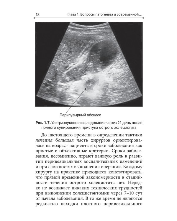 Интервенционная холецистостомия при остром холецистите в лечении пациентов старших возврастных групп