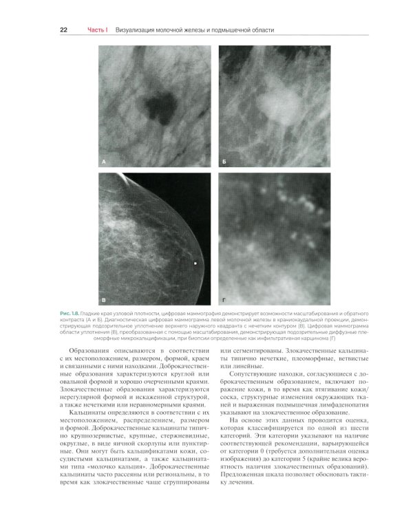 Хирургия молочной железы