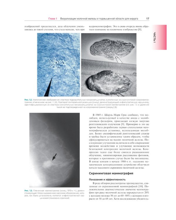 Хирургия молочной железы