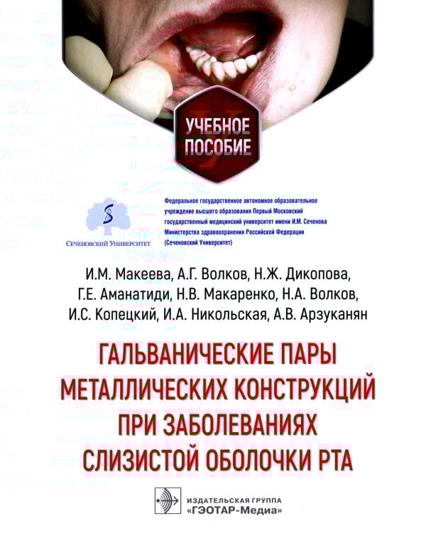 Гальванические пары металлических конструкций при заболеваниях слизистой оболочки рта: Учебное пособие