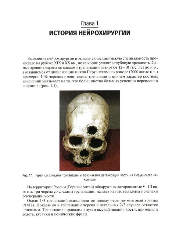 Неврология и нейрохирургия. В 2 т. Т. 2. Нейрохирургия: Учебник. 5-е изд., доп