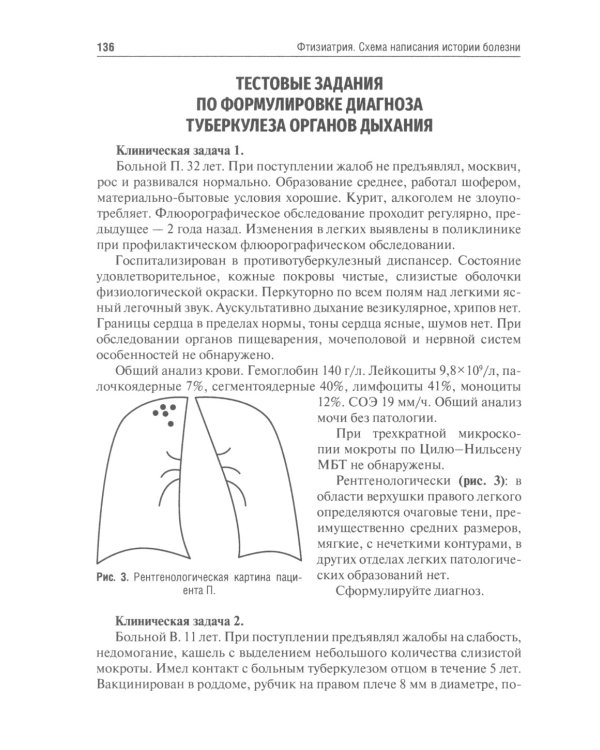 Фтизиатрия. Схема написания истории болезни: Учебно-методическое пособие