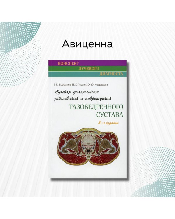 Лучевая диагностика заболеваний и повреждений тазобедренного сустава. Руководство