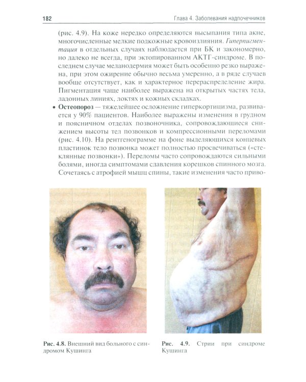 Эндокринология. Учебник. 3-е изд., перераб.и доп