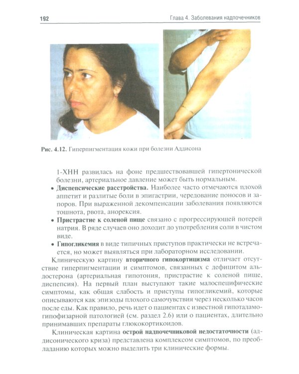 Эндокринология. Учебник. 3-е изд., перераб.и доп