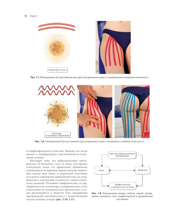 Нейромышечное тейпирование. Лечение отеков, гематом и рубцов