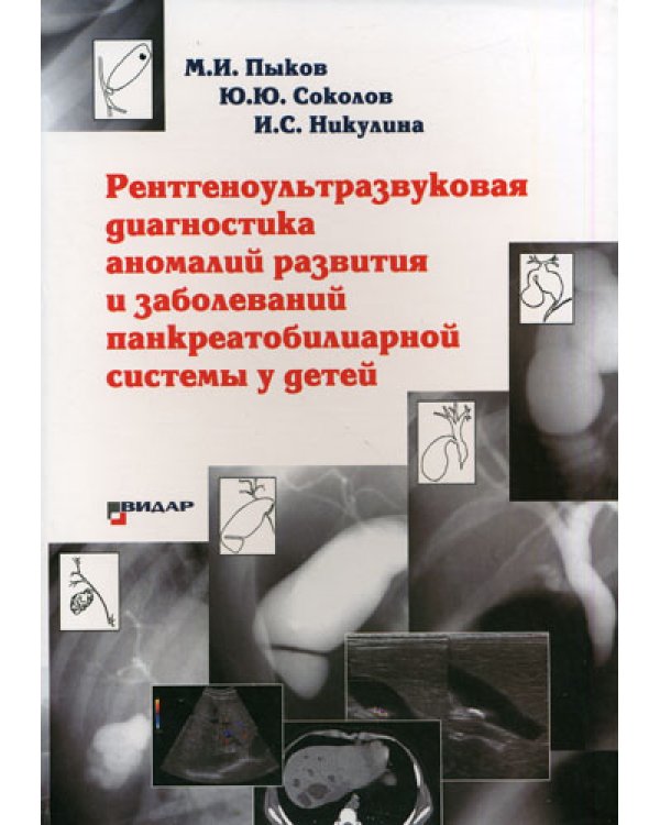Рентгеноультразвуковая диагностика аномалий развития и заболеваний панкреатобилиарной системы у детей