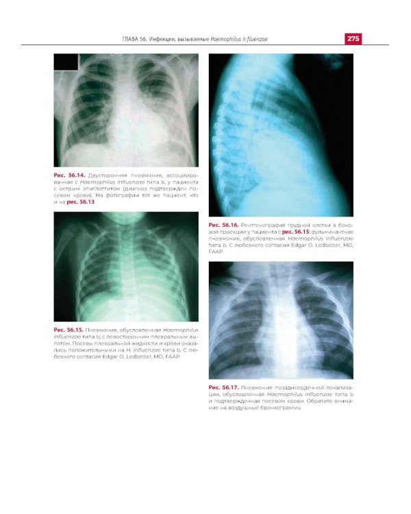 Атлас детских инфекционных заболеваний. 2-е изд