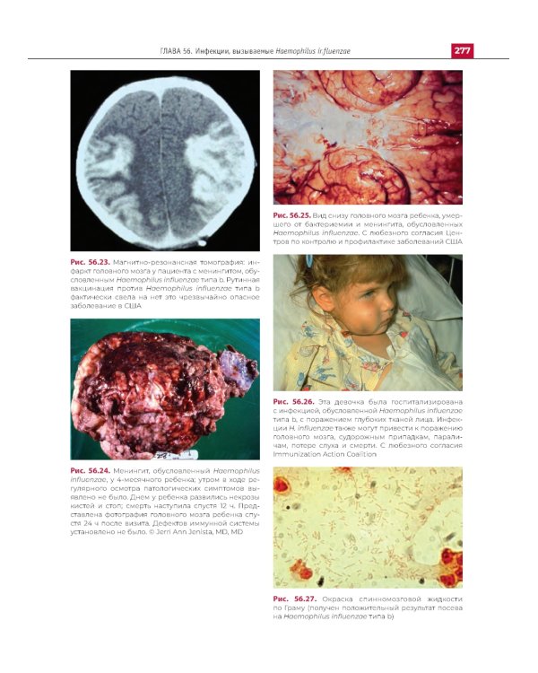 Атлас детских инфекционных заболеваний. 2-е изд