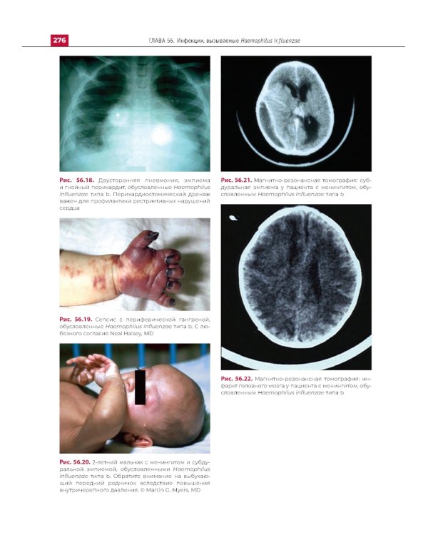 Атлас детских инфекционных заболеваний. 2-е изд