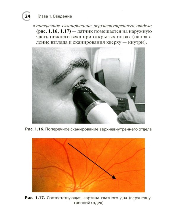 УЗИ в офтальмологии