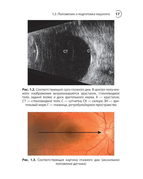 УЗИ в офтальмологии