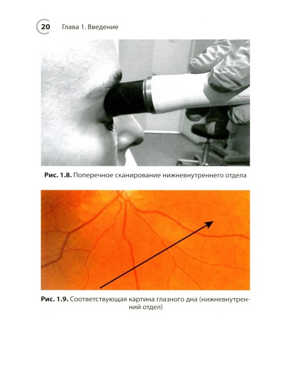 УЗИ в офтальмологии