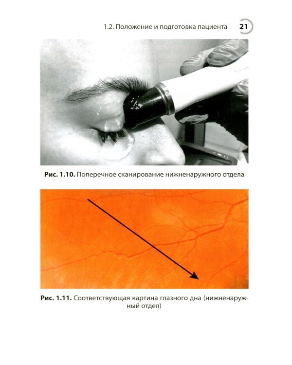 УЗИ в офтальмологии