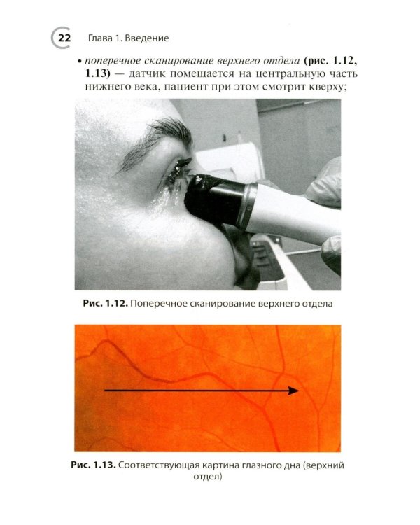 УЗИ в офтальмологии