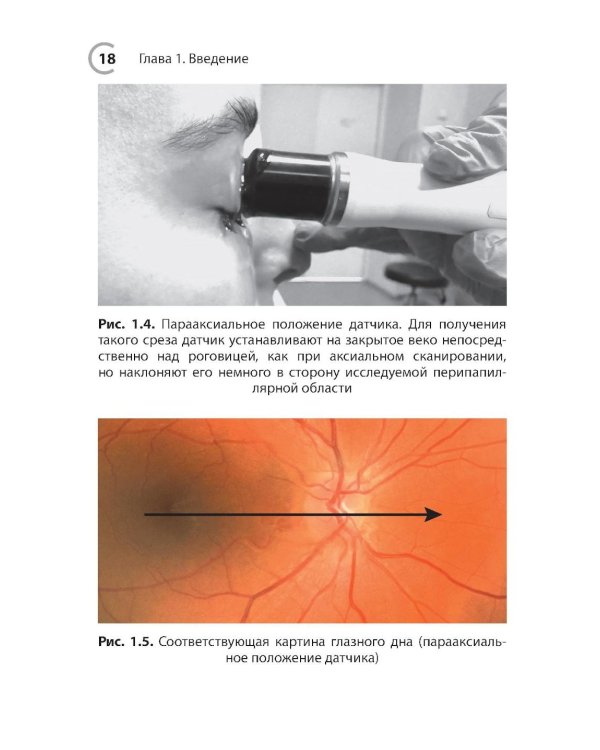 УЗИ в офтальмологии