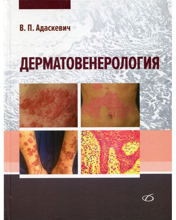 Дерматовенерология