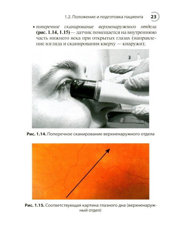 УЗИ в офтальмологии