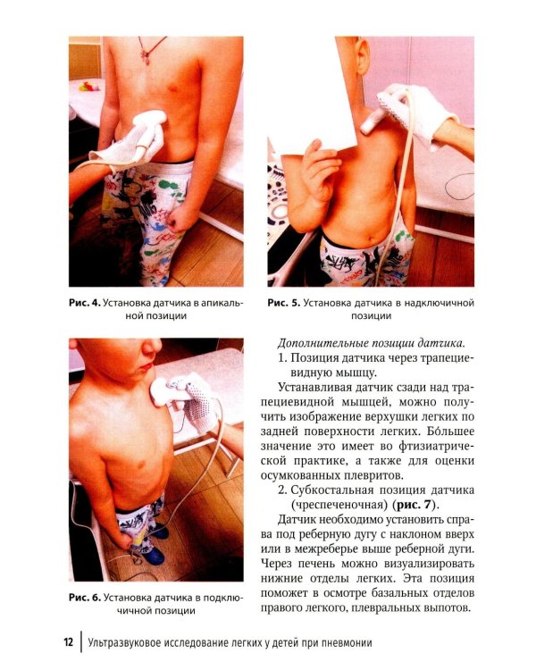 Ультразвуковое исследование легких у детей при пневмонии