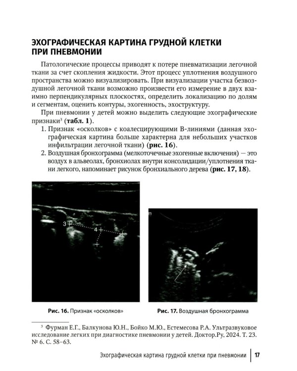 Ультразвуковое исследование легких у детей при пневмонии