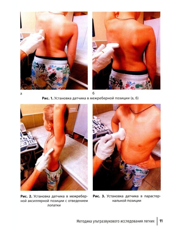 Ультразвуковое исследование легких у детей при пневмонии