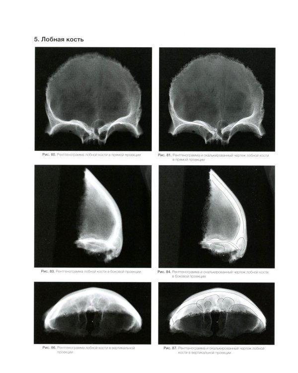 Атлас рентгенологической цефалометрии
