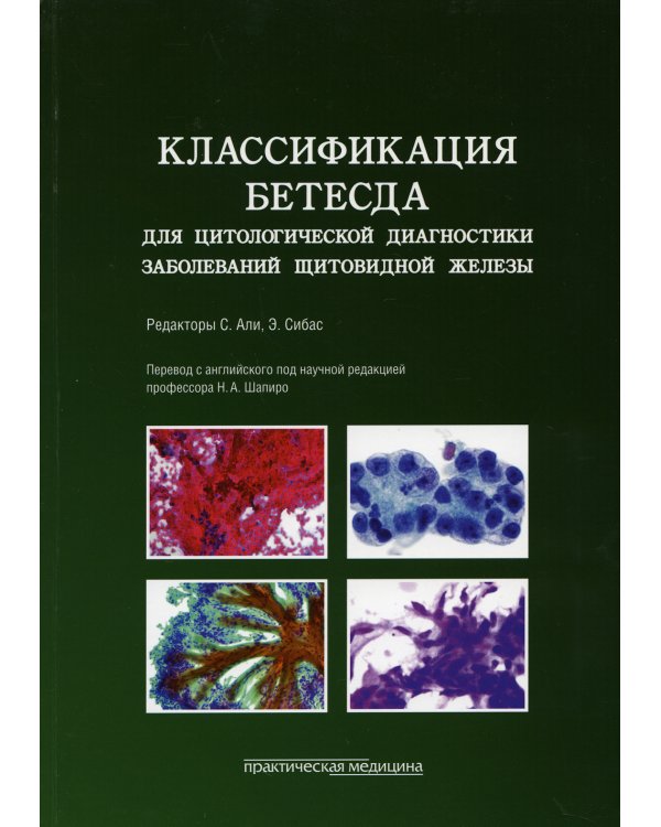 Классификация Бетесда для цитологической диагностики заболеваний щитовидной железы: терминология, критерии и пояснения