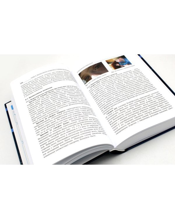 Детская неврология и нейрохирургия: Учебник: В 2-х т (комплект)