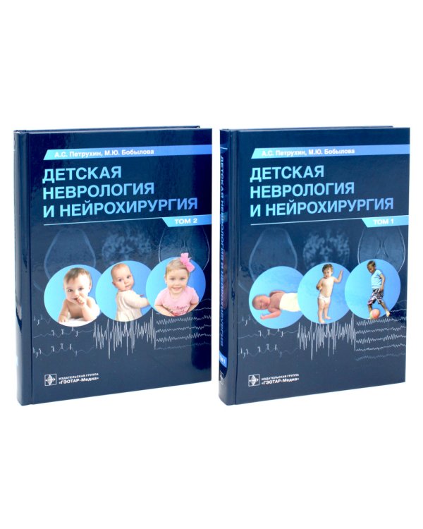 Детская неврология и нейрохирургия: Учебник: В 2-х т (комплект)