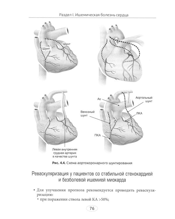 Диетотерапия ишемической болезни сердца