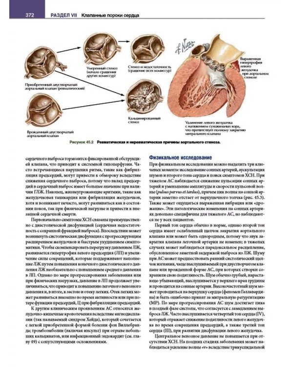 Кардиология с иллюстрациями Неттера. В 2 ч. (комплект из 2 кн.)