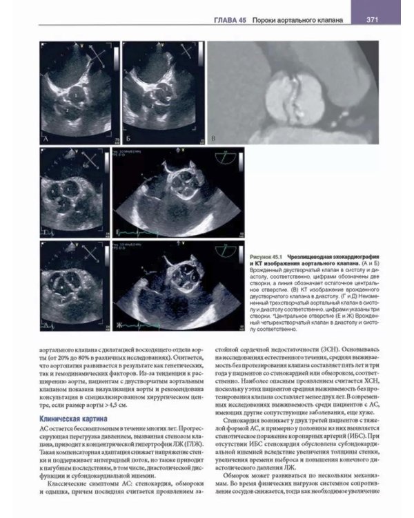 Кардиология с иллюстрациями Неттера. В 2 ч. (комплект из 2 кн.)