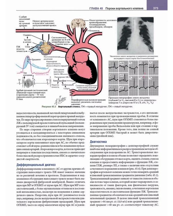 Кардиология с иллюстрациями Неттера. В 2 ч. (комплект из 2 кн.)
