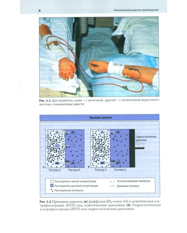 Клинический диализ: руководство