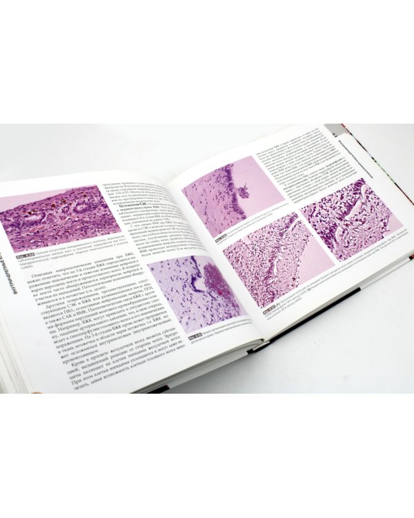 Патология головного мозга у новорожденных и детей раннего возраста
