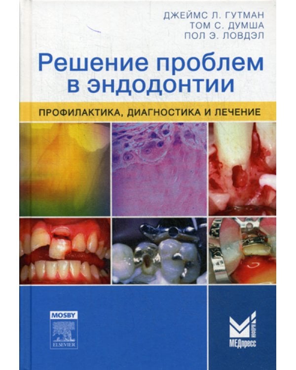 Решение проблем в эндодонтии. Профилактика, диагностика и лечение. 2-е изд