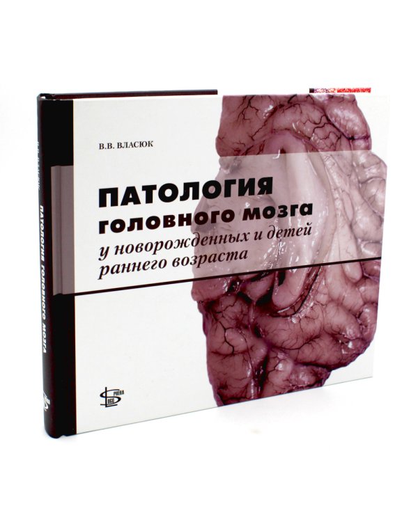 Патология головного мозга у новорожденных и детей раннего возраста