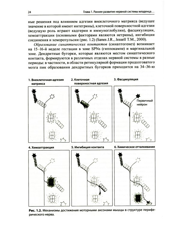 Энцефалопатии новорожденных детей