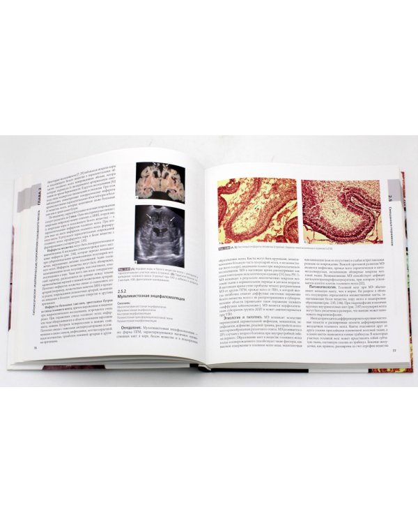 Патология головного мозга у новорожденных и детей раннего возраста