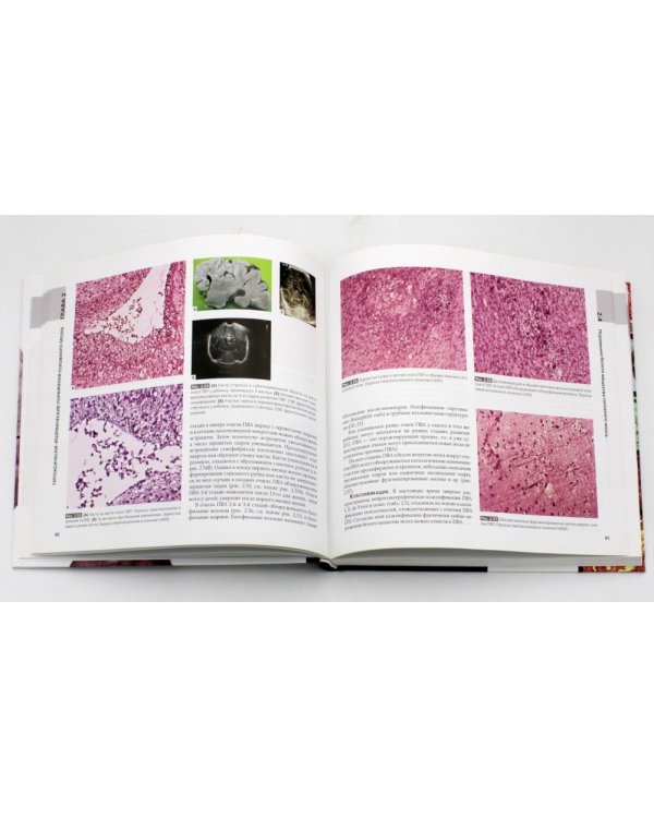 Патология головного мозга у новорожденных и детей раннего возраста