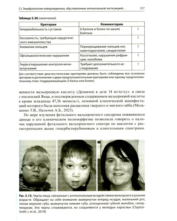 Энцефалопатии новорожденных детей