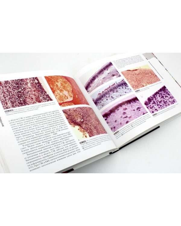 Патология головного мозга у новорожденных и детей раннего возраста