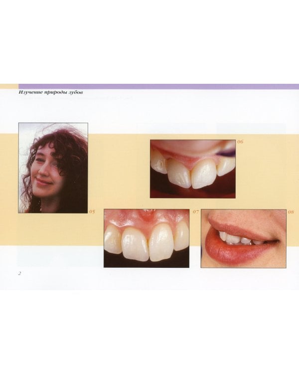 Вдохновение. Естественные реставрации зубов