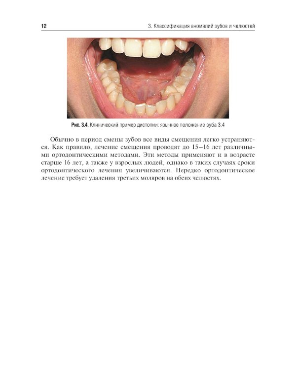 Болезни прорезывания зубов: Учебное пособие. 2-е изд., испр. и доп