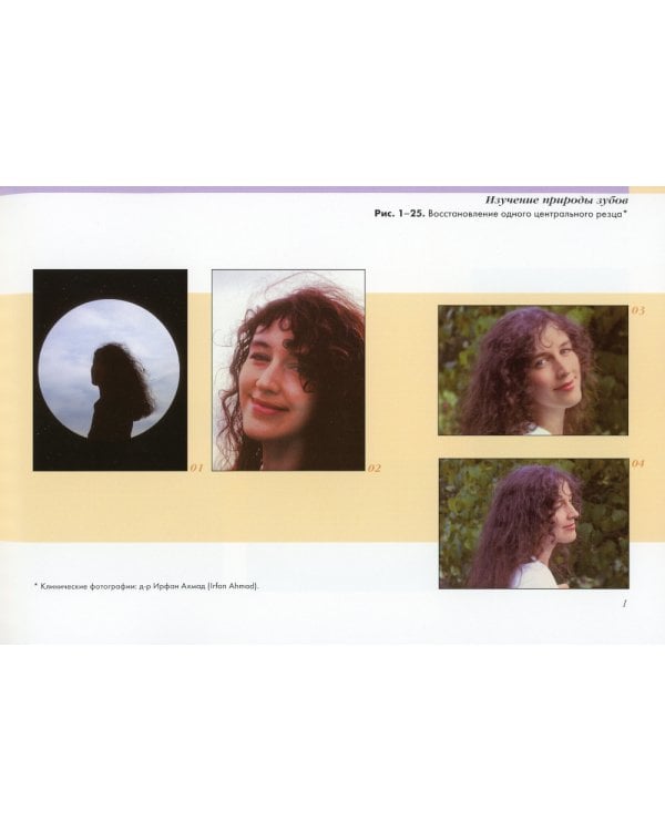 Вдохновение. Естественные реставрации зубов