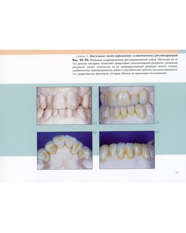 Вдохновение. Естественные реставрации зубов