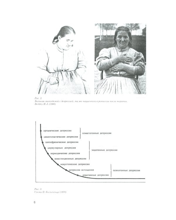 Диагностика депрессии (учебный атлас): Учебное пособие